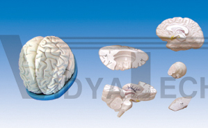 The dissection model of brain and ventricle (5 parts)